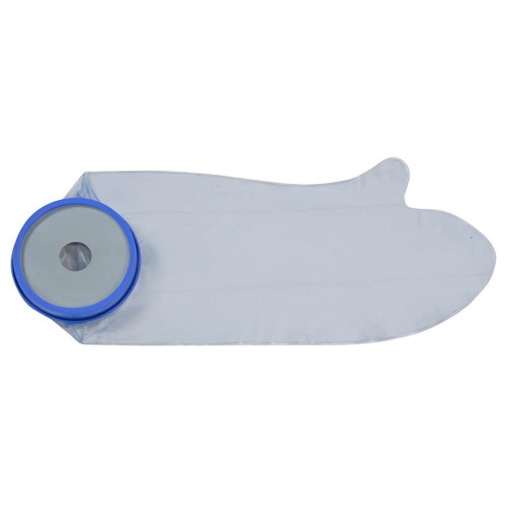 arm cast